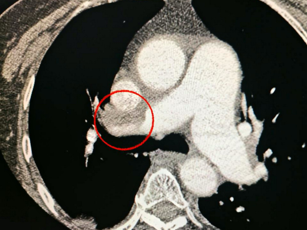 8251 image for slide