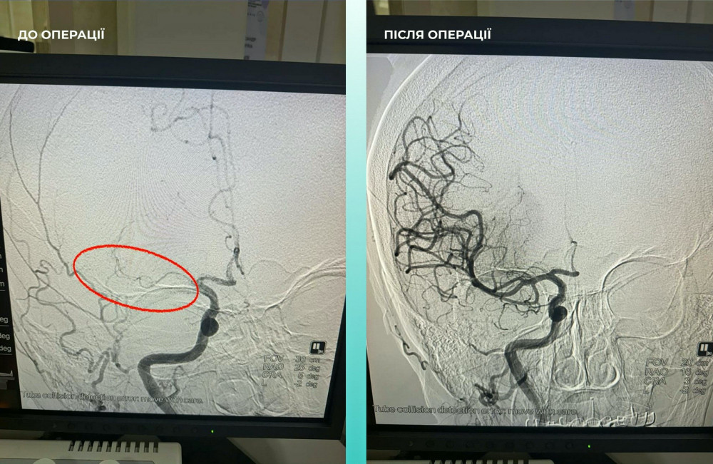 8253 image for slide