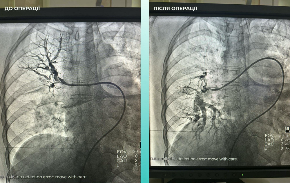 8255 image for slide